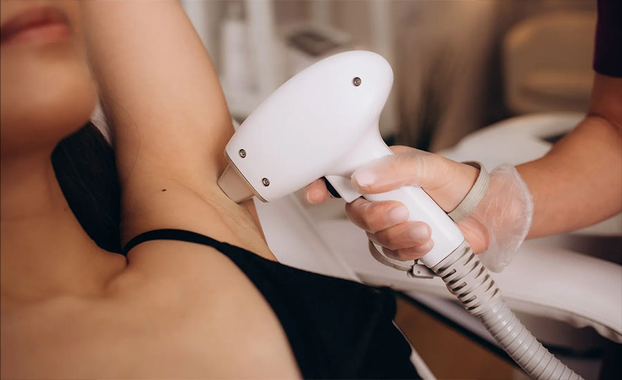 Ankara lazer epilasyon 2